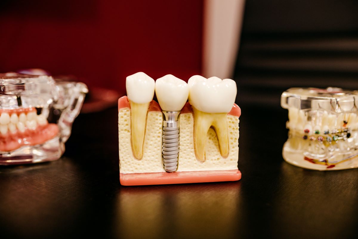 Implante dentário dói?